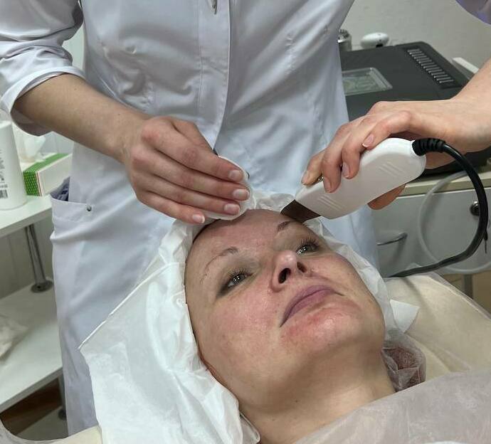 ультразвук аппаратная чистка