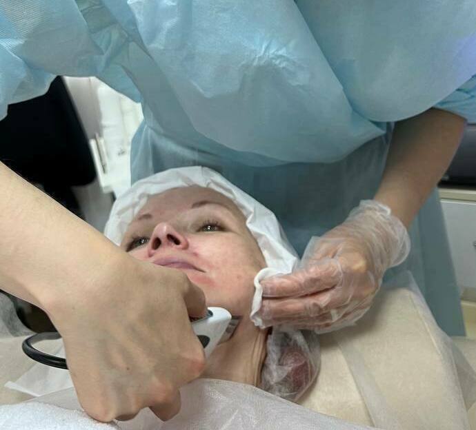 Ультразвуковая чистка лица Аппаратная чистка